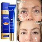 Contorno de Ojos Reparador SADOER con Caviar y Ácido Hialurónico 20 g