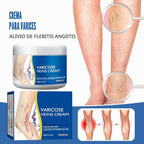Crema para Piernas con Varices