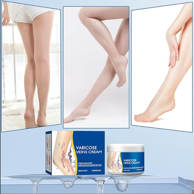 Crema para Piernas con Varices