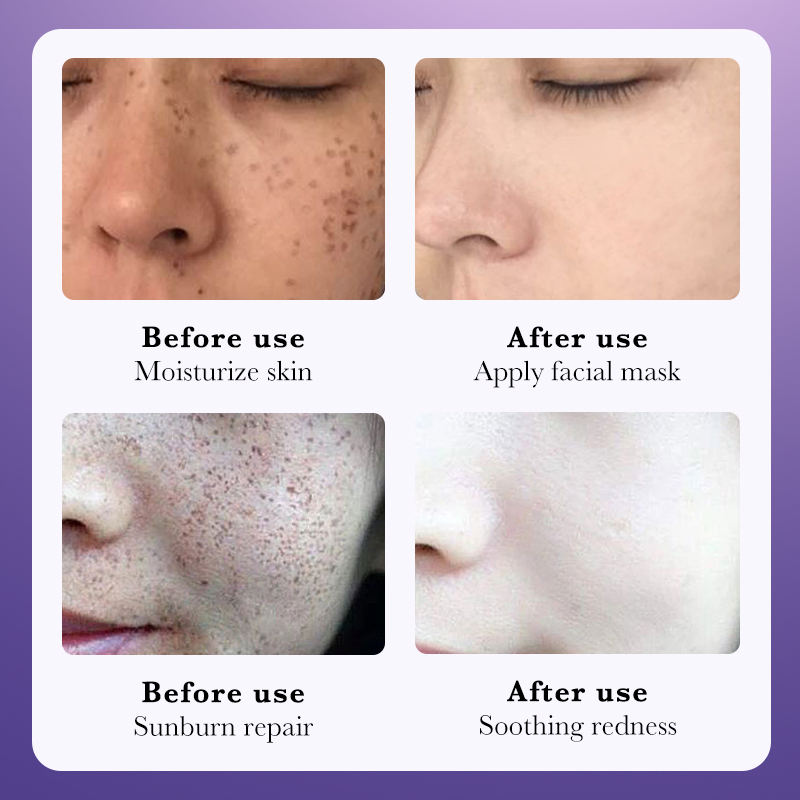 Solución Blanqueante & Suavizante con Nicotinamida (30ml) – Ilumina, Hidrata y Unifica el Tono de la Piel