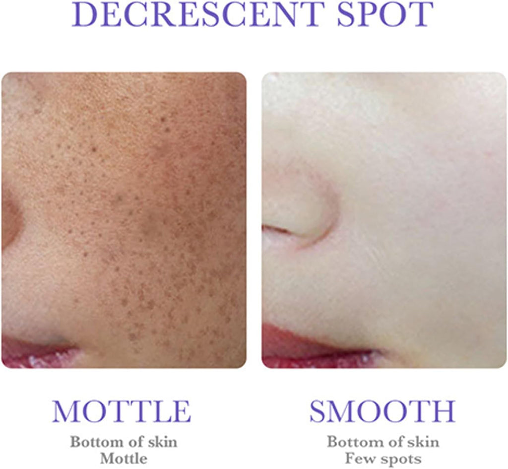 Solución Blanqueante & Suavizante con Nicotinamida (30ml) – Ilumina, Hidrata y Unifica el Tono de la Piel