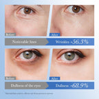 Contorno de Ojos Reparador SADOER con Caviar y Ácido Hialurónico 20 g
