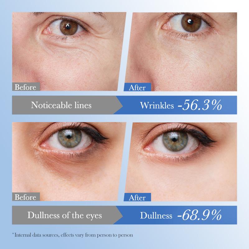 Contorno de Ojos Reparador SADOER con Caviar y Ácido Hialurónico 20 g