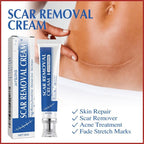Crema para Eliminar Cicatrices 30GR JAYSUING