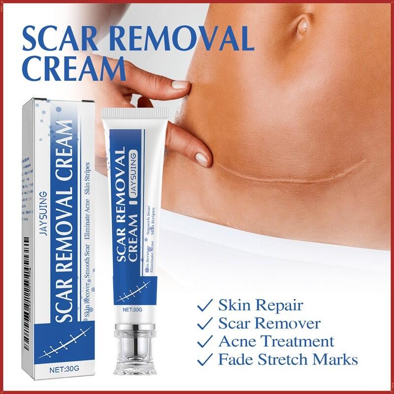 Crema para Eliminar Cicatrices 30GR JAYSUING
